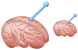 Brain probe